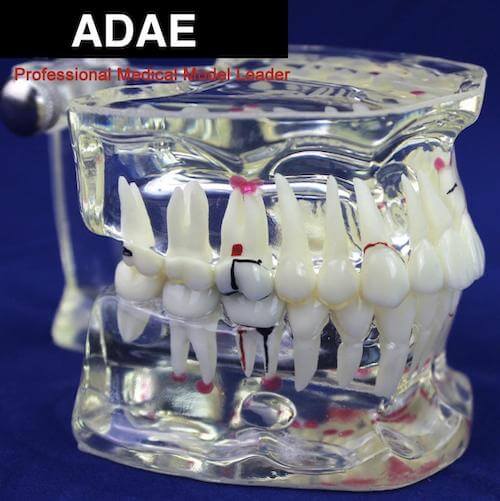 Dental anatomical models