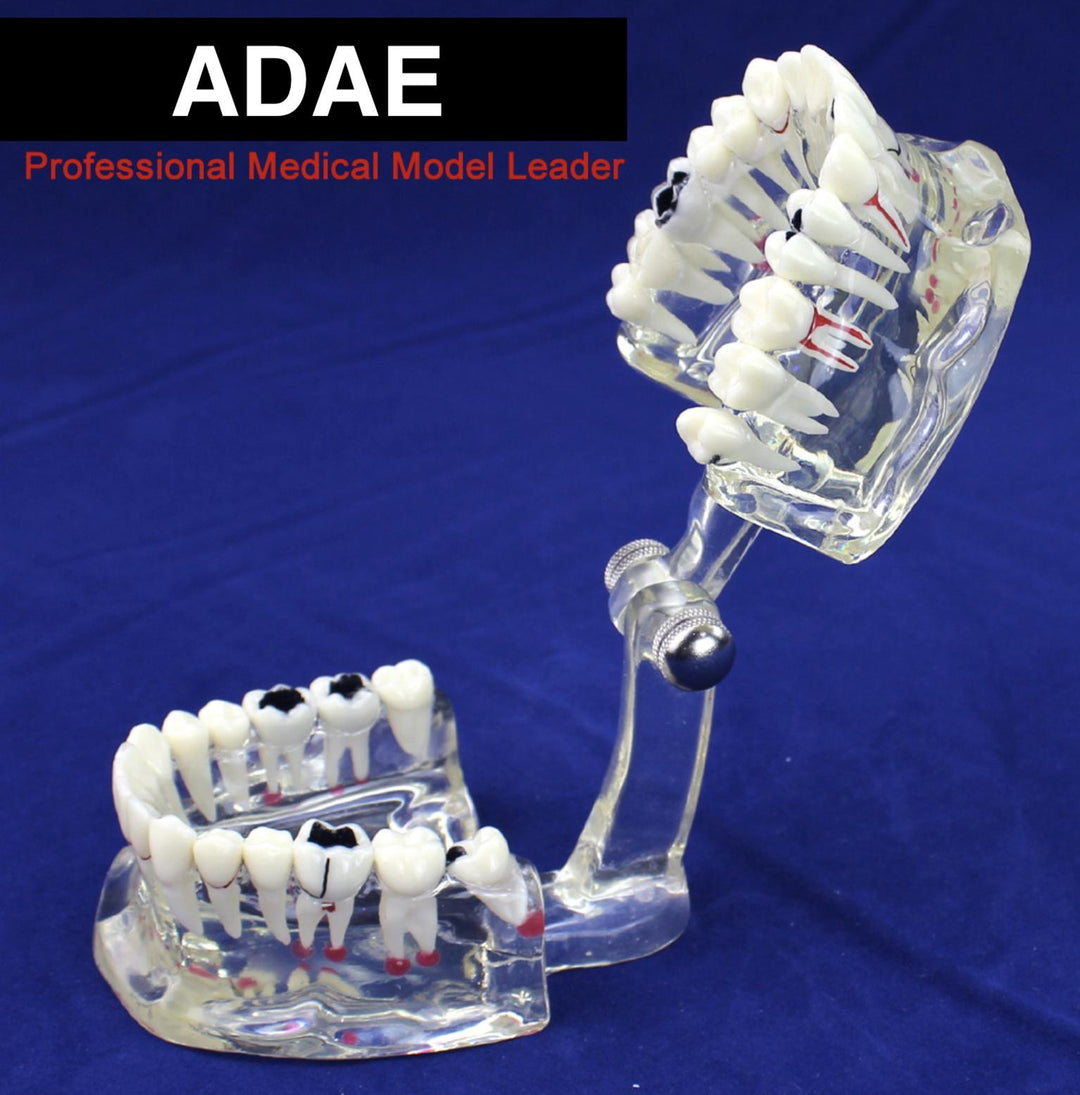 ADAE AD017 adult transparent dental illustration model ( natural size) - ADAE Dental Online Store