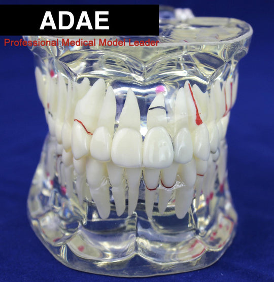 ADAE AD017 adult transparent dental illustration model ( natural size) - ADAE Dental Online Store