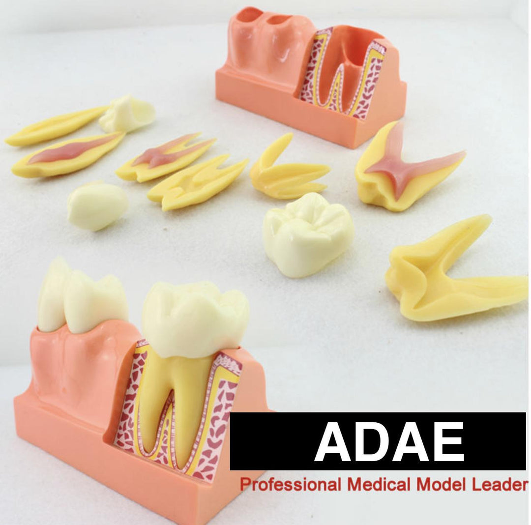ADAE AD076 tooth anatomical structure illustration model (Size :X 4 times) - ADAE Dental Online Store